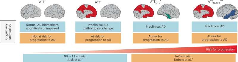 Alzheimer's disease can be diagnosed before symptoms emerge 