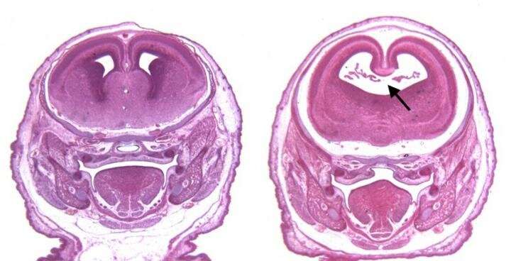 CBD, THC use during early pregnancy can disrupt fetal development