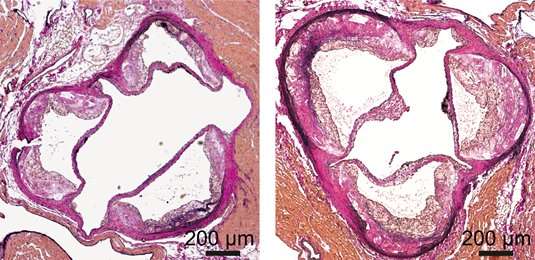 Dicer enzyme cuts down on fats 