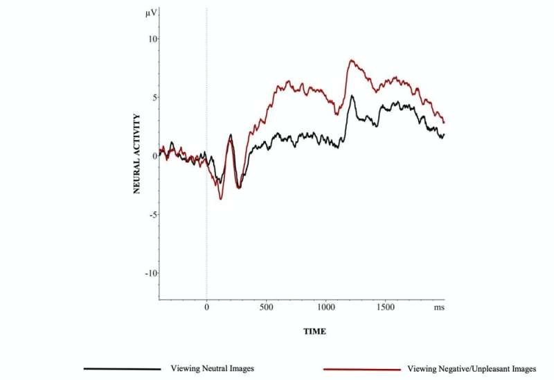 Pregnant women's brains show troubling signs of stress – but feeling strong social support can break those patterns