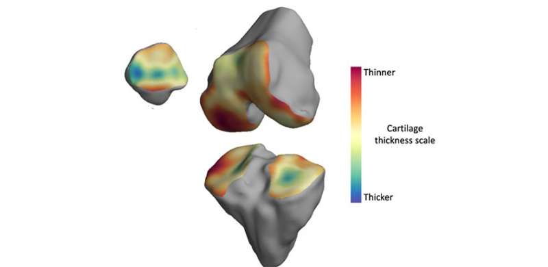 Improved MRI scans could aid in development of arthritis treatments