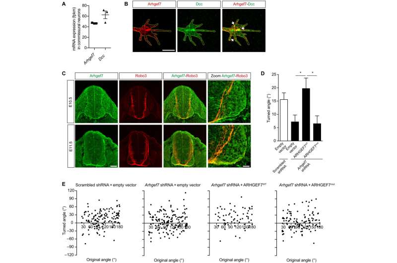 Scientists identify mutated gene behind mirror movement disorder