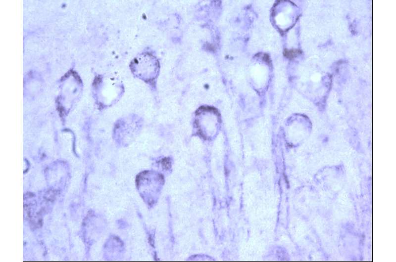 Chaperone protein imbalance promotes toxic tau buildup in the aging brain 