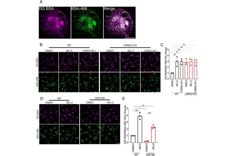 Study reveals insights into link between genetic mutation and Parkinson's