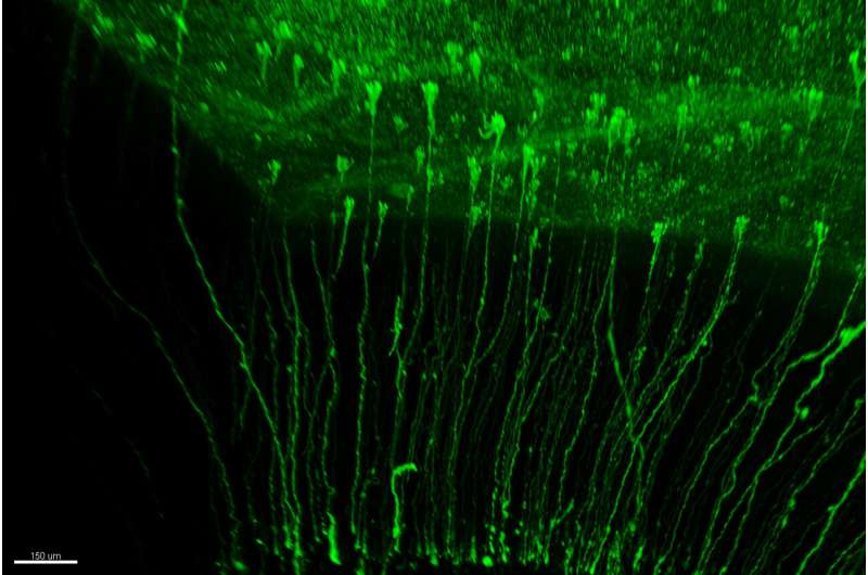 Study Uncovers Multiple Lineages of Stem Cells Contributing to Neuron Production