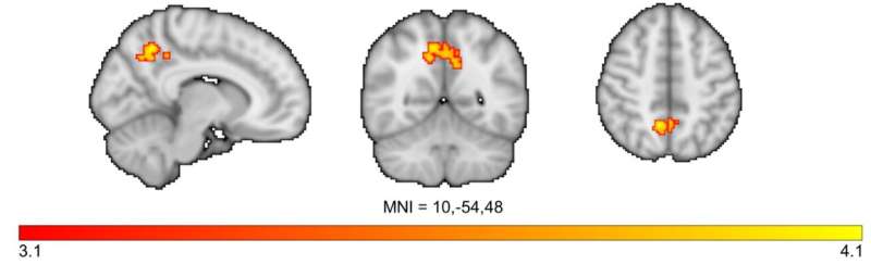 Stress activates brain regions linked to alcohol use disorder differently for women than men, finds study