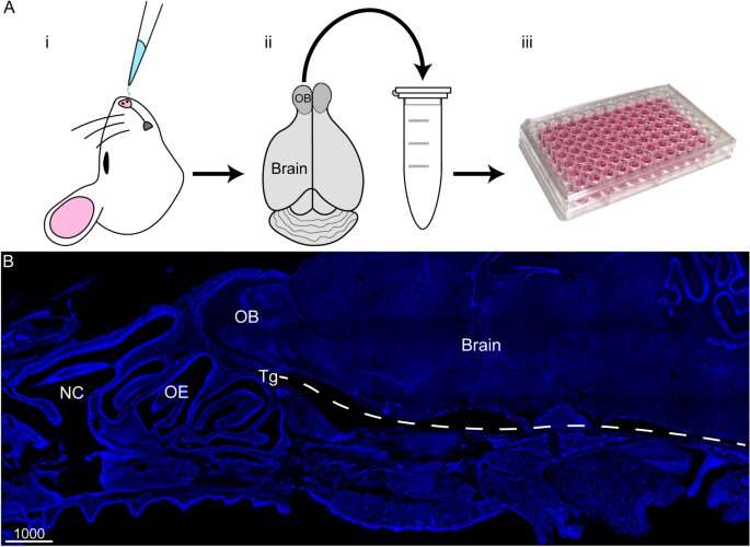 Bacteria in the nose may increase risk of Alzheimer's disease 