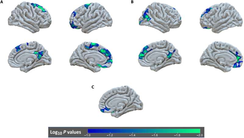 Early deprivation continues to affect brain development well into adolescence, researchers find 