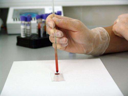 Testing reveals transfusing young blood into Alzheimer's patients does not reverse disease 