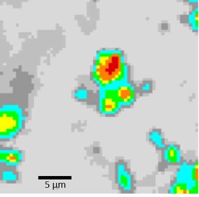 Imaging technique shows progress Alzheimer's disease