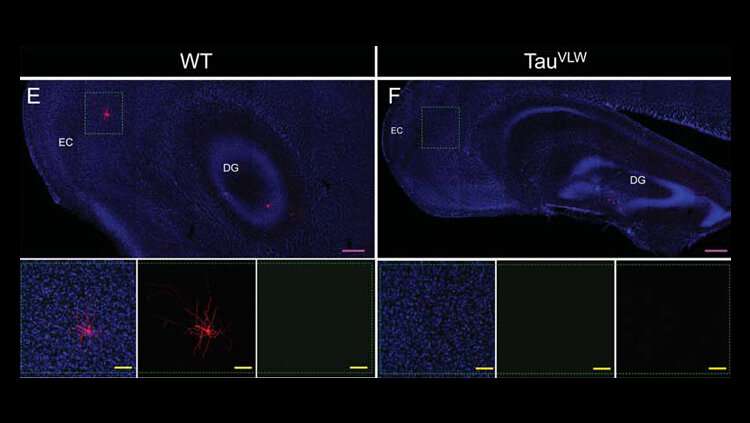 Broken brain cells repaired in dementia mouse model 