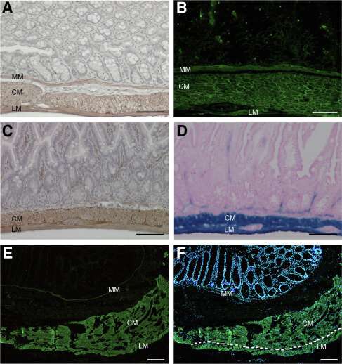 New study identifies potential therapeutic target for colonic disorders