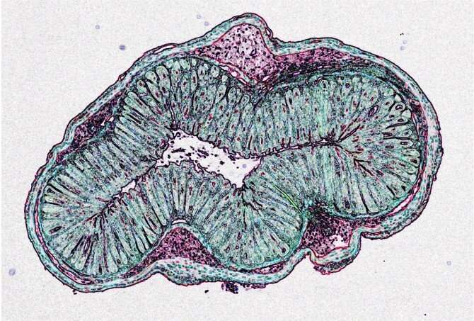 Cells help immune system tolerate friendly gut bacteria