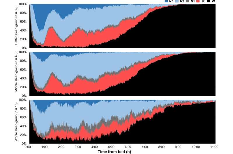 Cumulative displays of sleep architecture by electroencephalogram-based sleep cluster. The X-axis indicates the time from bed, whereas the Y-axis indicates the percentage of people in each sleep stage: awake ("W"), N1, N2, N3, and REM ("R"). Credit: Scientific Reports (2023). DOI: 10.1038/s41598-023-47979-9