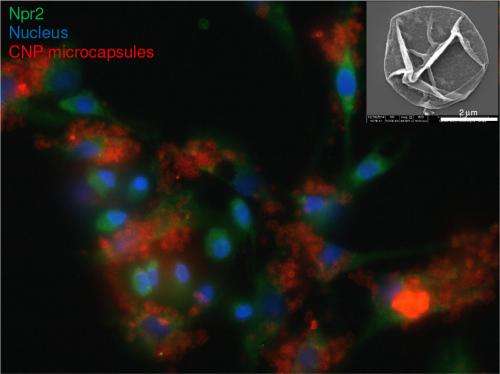 New 'microcapsules' have potential to repair damage caused by osteoarthritis 