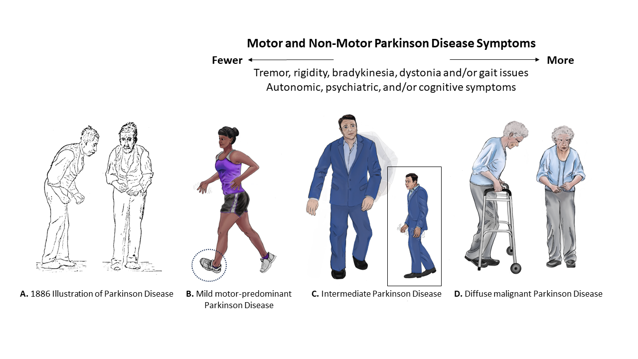 Understanding and Treating Parkinson's Disease: Unraveling Molecular Signals and Therapeutic Strategies