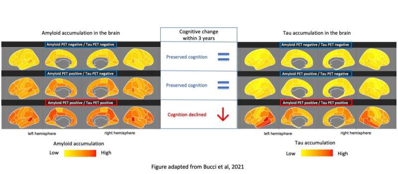 Early accumulation of tau in the brain predicts memory decline in Alzheimer's disease 