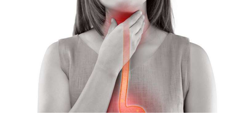 The largest study of its kind shows a need for improvement in esophageal cancer screenings 