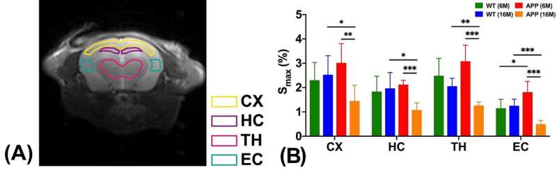 Early detection of Alzheimer's disease with dynamic MRI measurement of glucose in brain