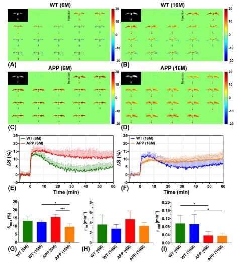 Early detection of Alzheimer's disease with dynamic MRI measurement of glucose in brain