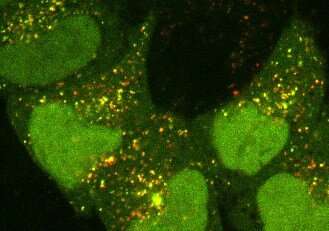 Insight into cells' 'self-eating' process could pave the way for new dementia treatments