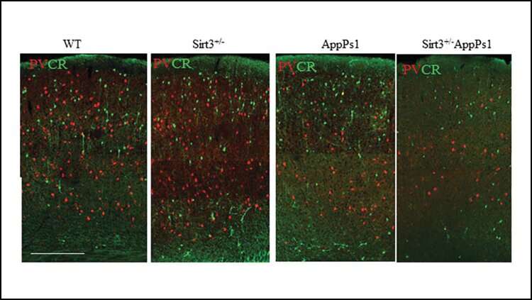 Eating more ketones may fight against Alzheimer's disease