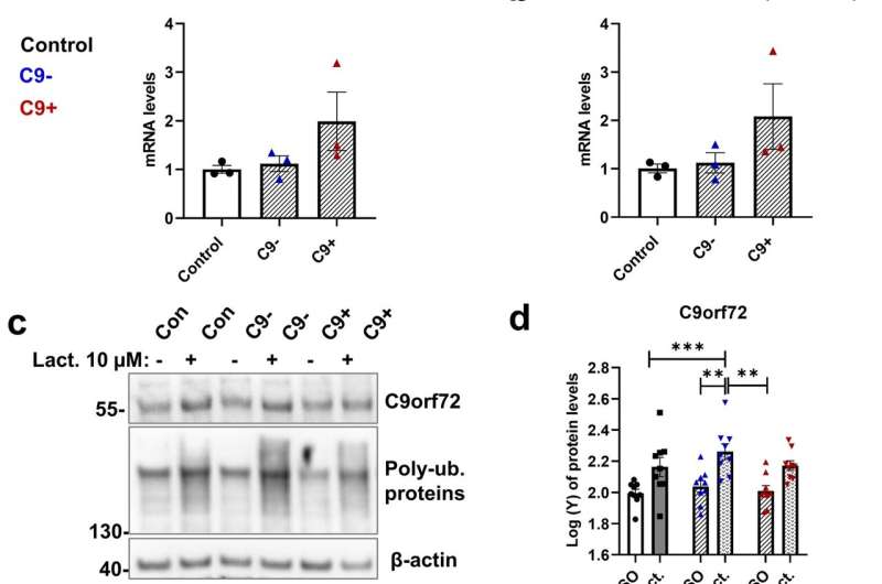 Skin cells from frontotemporal dementia patients may reveal disease mechanisms and biomarkers for drug research 