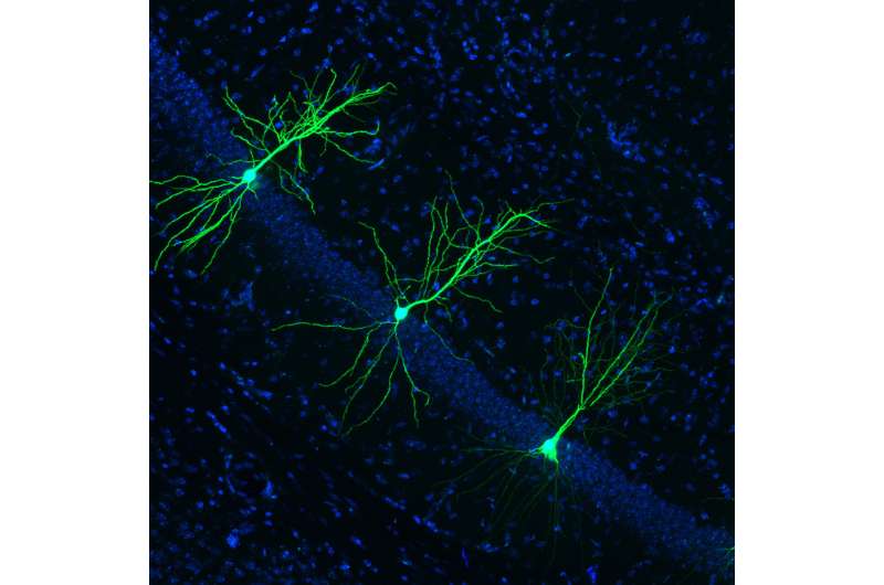 New target for drug intervention in Alzheimer's disease identified 