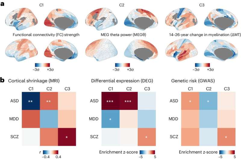 Study links the genetic organisation of healthy brains to autism and schizophrenia