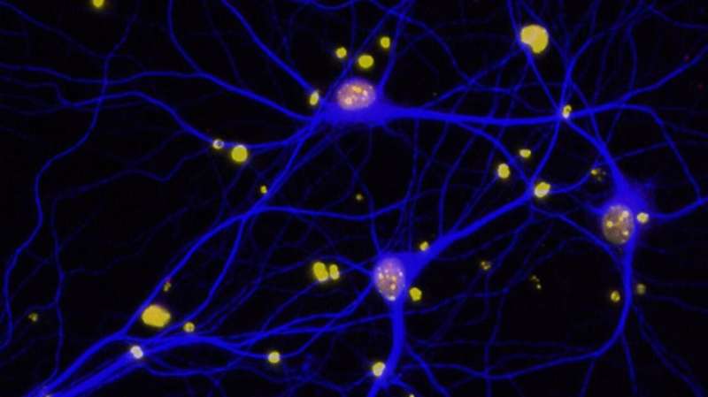 Modified protein can prevent Alzheimer’s disease in mice