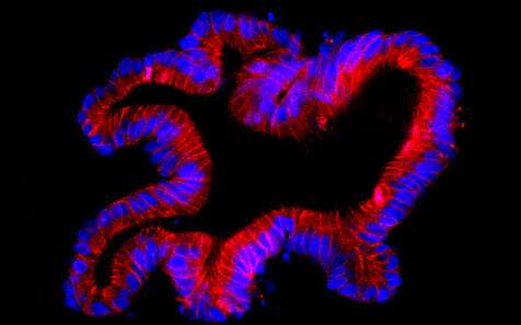 Solving the riddle of superbug toxin damage to gut