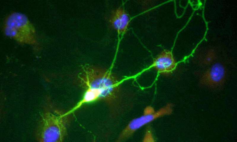 Protein modification of a gene expression regulator can confer neuroprotection against inflammation 