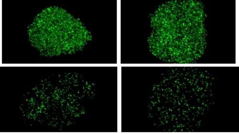 Brain cell death in ALS, dementia tied to loss of key biochemical transport structure in nucleus 