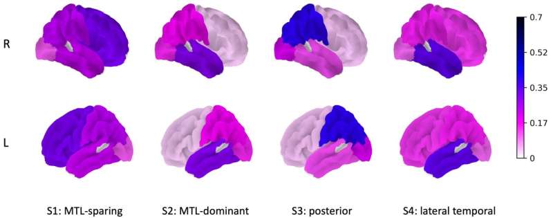 Genomics- and image-guided subtyping refines characterization of Alzheimer's disease