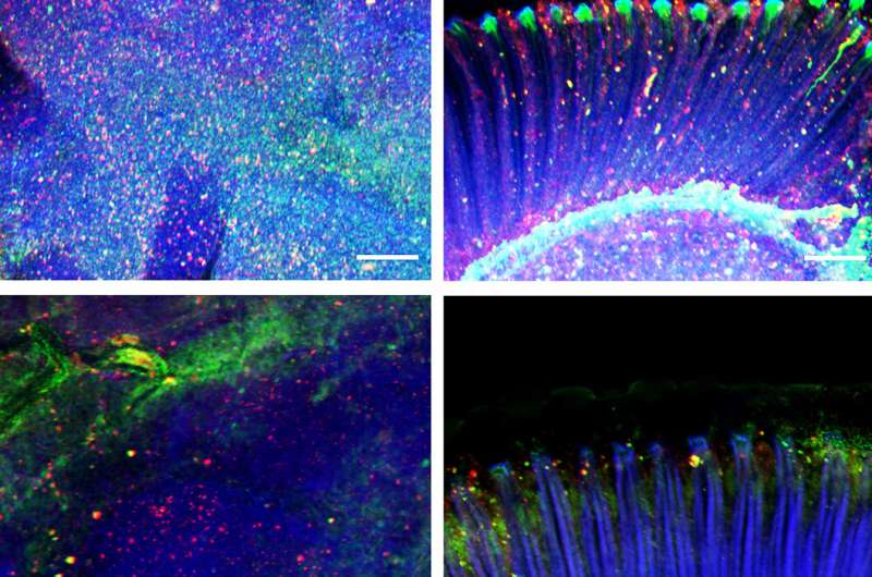 Signals from muscle protect from dementia 