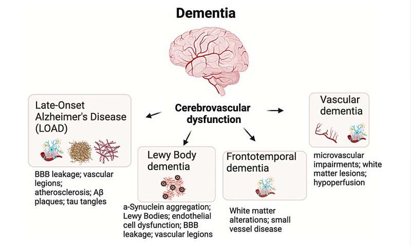 The aging brain and peripheral vascular dysfunction