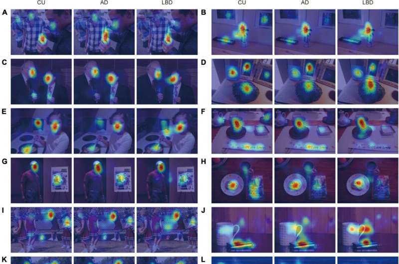 AI-based diagnostic tool differentiates dementia diseases by analysis of eye movement patterns  