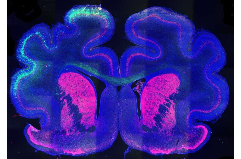 Possible mechanism for fold formation in the cerebral cortex discovered 