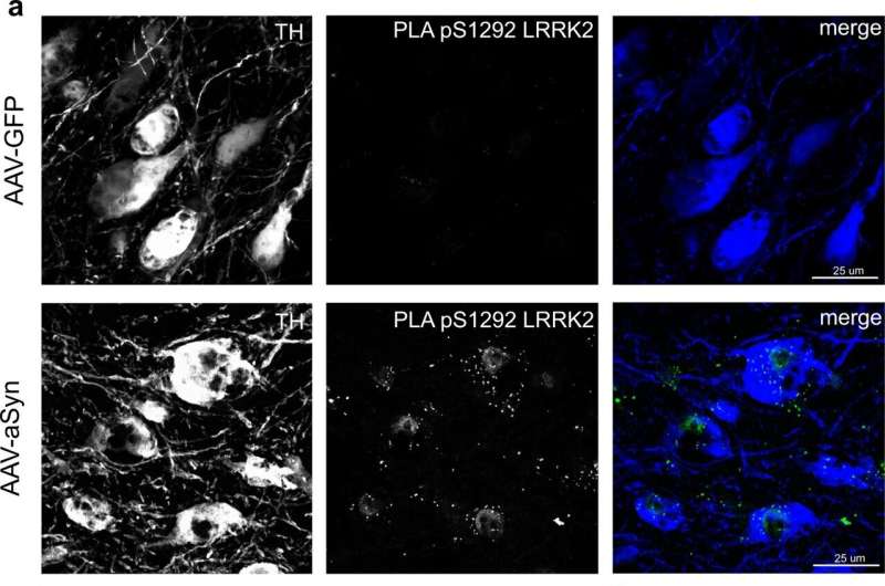 Risk factors for Parkinson's disease: Study proves the protective function of the RIT2 gene 