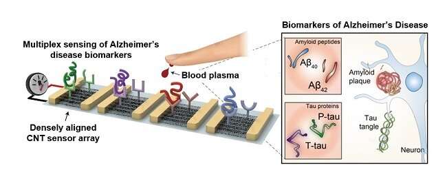 Blood-based multiplexed diagnostic sensor helps to accurately detect Alzheimer's disease 