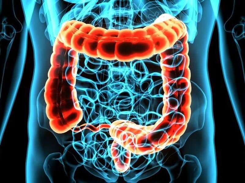 Fecal microbiota transplant effective for immune-mediated colitis