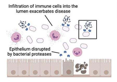 Digitized number 2: stool samples reveal microbial enzyme driving bowel disease