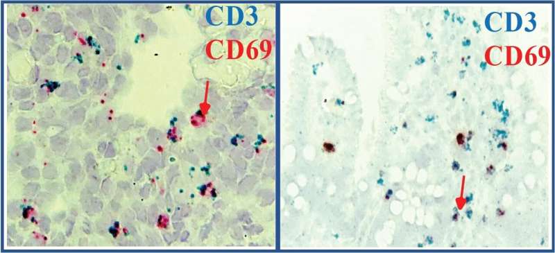 Gut immunity more developed before birth than previously thought