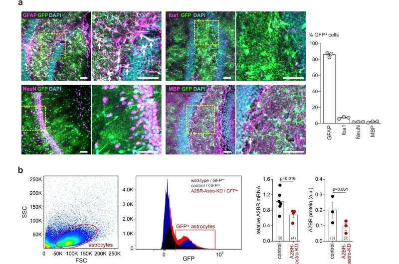 Discovery of cellular mechanism to maintain brain's energy could benefit late-life brain health