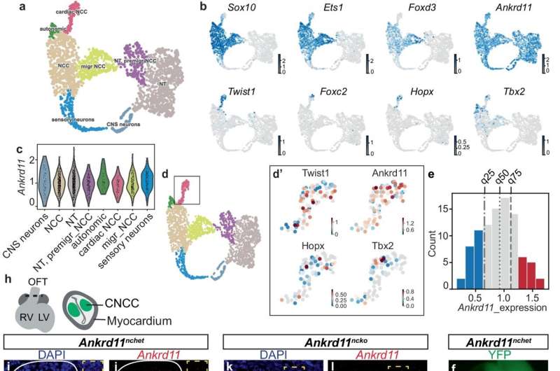 Study discovers connection between between heart and brain in KBG syndrome