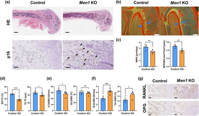 New insights into osteoporosis