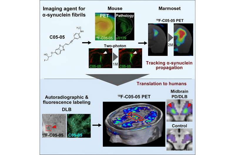 Visualizing core pathologies of Parkinson's disease and related disorders in live patients