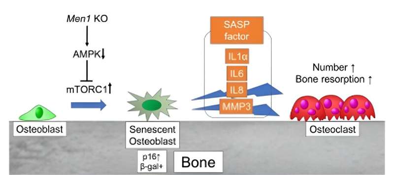 New insights into osteoporosis