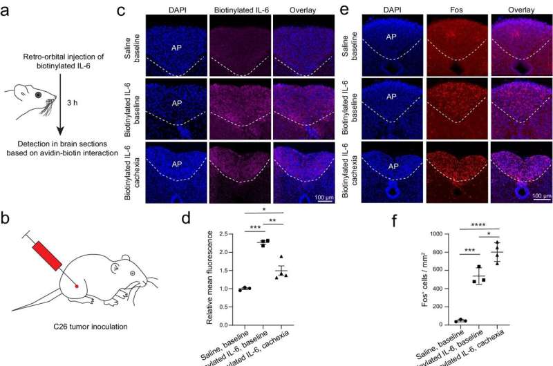 Pulsed field ablation procedures found safe and effective for atrial fibrillation patients