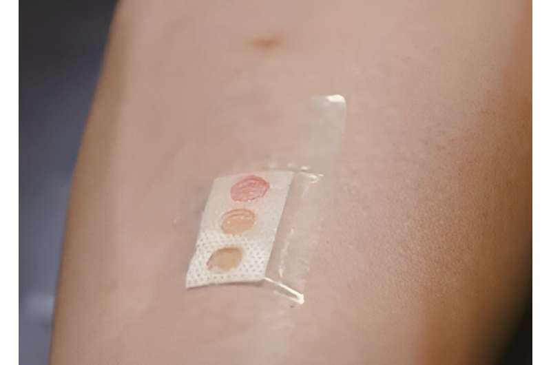 Scientists develop bandage that measures glucose levels in sweat using microlaser technology